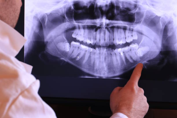 Best Emergency Treatment for Dental Infections or Abscesses in Garrison, TX