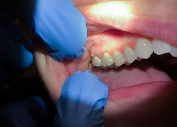 Best Same-Day Emergency Dental Services in Garrison, TX