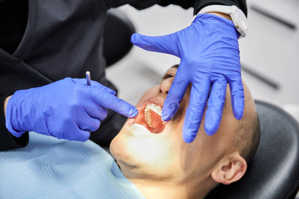 Best Same-Day Emergency Dental Services in Garrison, TX