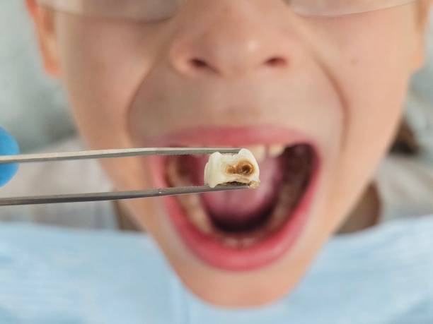 Best Emergency TMJ Treatment in Garrison, TX